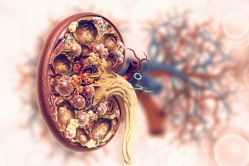 Pacientul cu boala cronica de rinichi – ajustarea dozelor de medicamente in functie de stadiul bolii renale