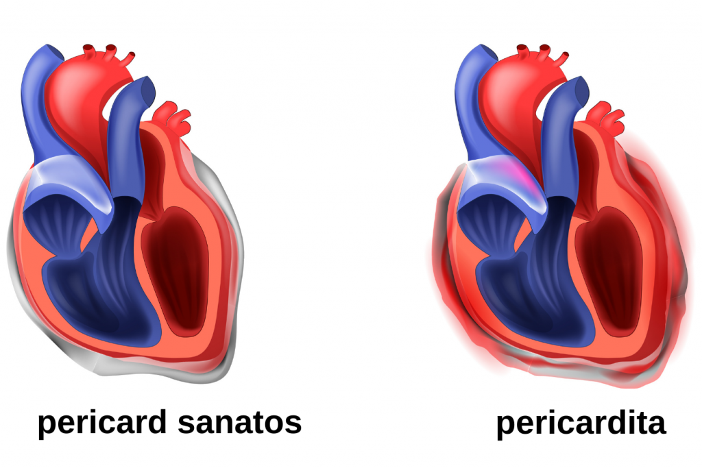 pericard