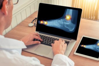 Glucozamina in tratamentul osteoartritei – exista beneficii dovedite?