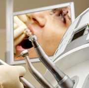 Implantul dentar: între rol și beneficii