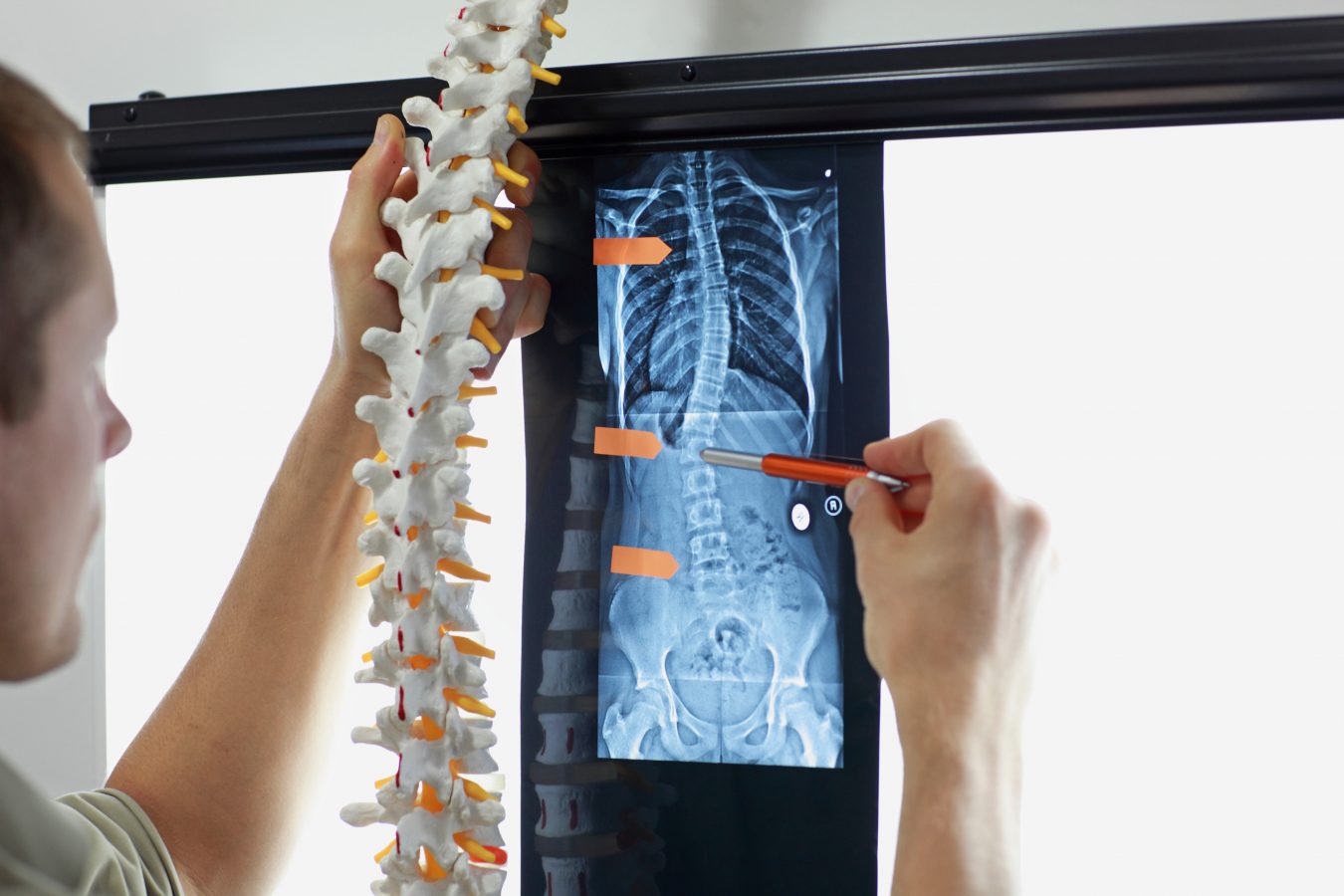 Chirurgia tradițională coloanei vertebrale | Humed International