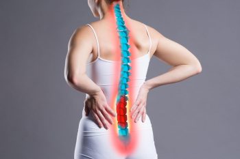 Tratamentul naturist al coloanei vertebrale