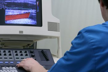 Sonoelastografia si ecografia Doppler, esentiale in diagnosticul diferential al nodulilor