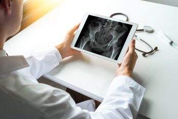 New insights into osteoporosis treatment strategy