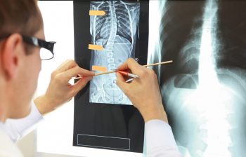 New insights in bone tissue engineering