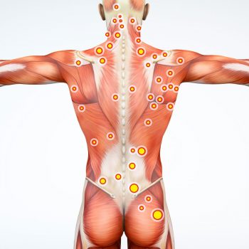 Bandeleta iliotibiala – simptome, diagnostic si tratament