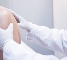 subcompensie tratamentul cu varicoza varicoza i glicina