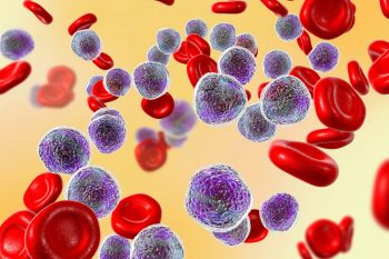 Comisia Europeană a aprobat BLINCYTO® pentru tratamentul adulților cu leucemie limfoblastică acută