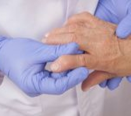 Afla totul despre artroza: Simptome, tipuri, diagnostic si tratament | starticket.ro