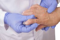 Boala artrozică: factori şi tratament