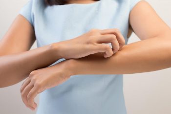 Dermatozele asociate expunerii la radiația ultravioletă