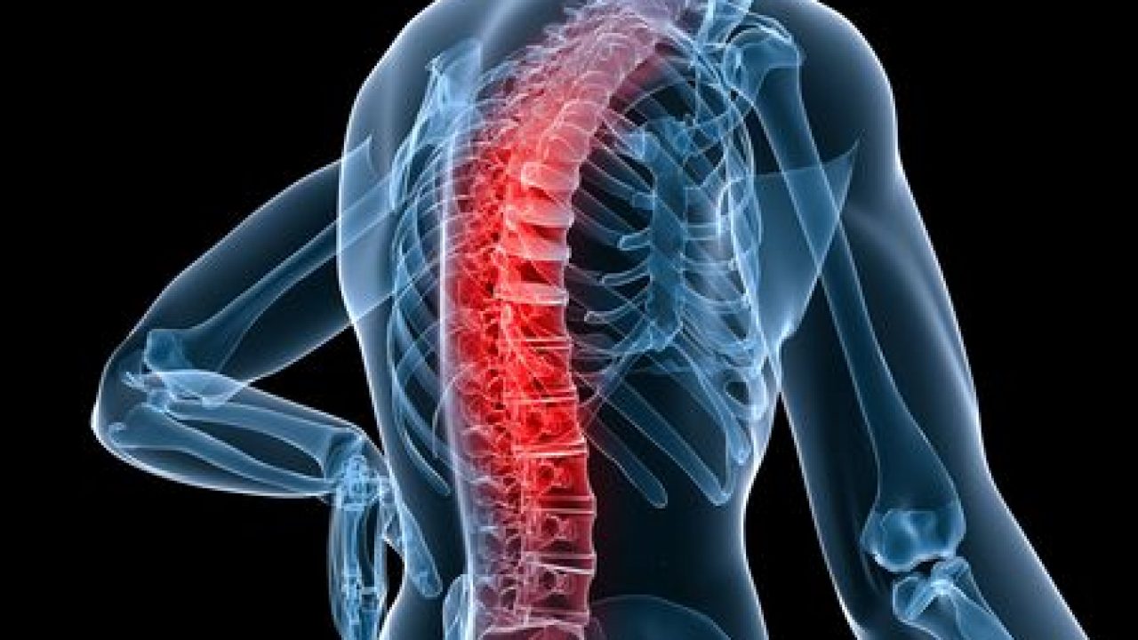 Conceptul DAVID de recuperare medicala a coloanei vertebrale | Regina Maria
