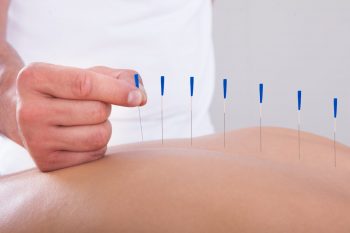 Metode neconvenționale de terapie în boala Alzheimer