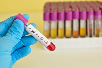 Actualități în tratamentul infecției cu Helicobacter pylori
