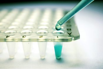 Evenimentele Asociației Medicale Române pentru Plasmafereză