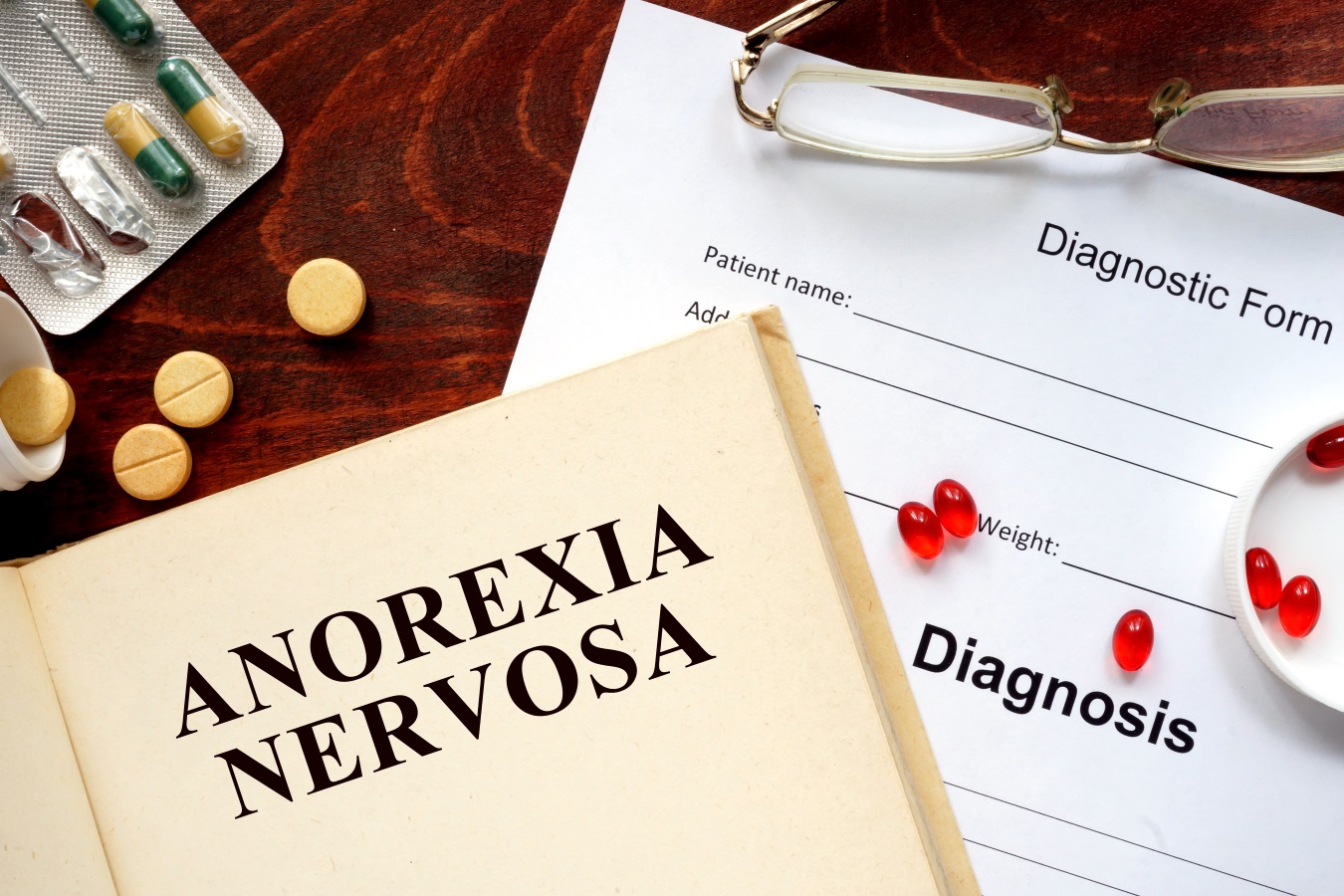 Criterii de diagnosticare pentru anorexia nervoasă