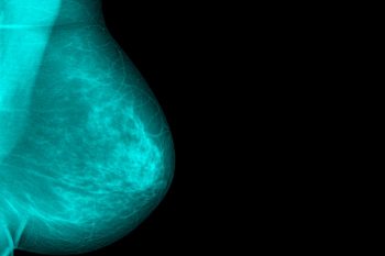 Conferința internațională dedicată cancerului mamar are loc în perioada 26-28 octombrie