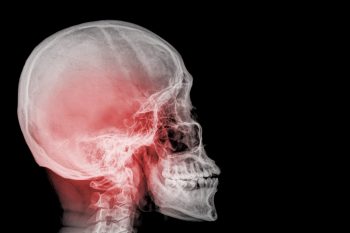 Conferința „Traumatismele craniofaciale ṣi cervicale – abordare diagnosticǎ ṣi terapeuticǎ”, 06-07 octombrie 2017