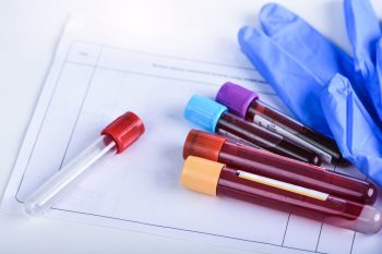 Bolile hematologice la copii și adulți
