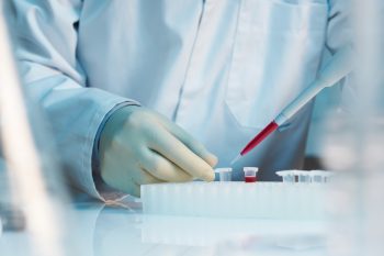 Anticorpii monoclonali: terapia viitorului în prevenirea migrenei