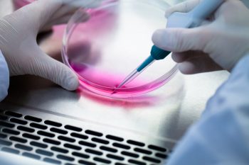 Ce se ascunde în spatele „somnului” celulelor canceroase?