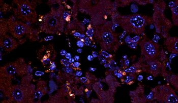 Un nou tratament împotriva bolilor autoimune cauzate de bacteriile intestinale