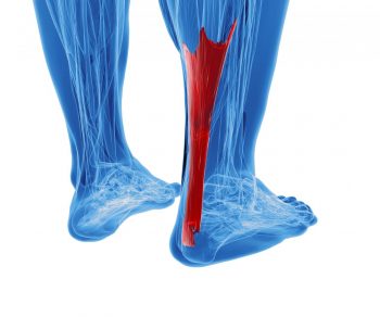 Leziunile traumatice ale tendonului ahilean: cauze și variante terapeutice