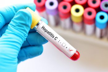 Pauză în programul fără interferon, pentru pacienții cu hepatita C