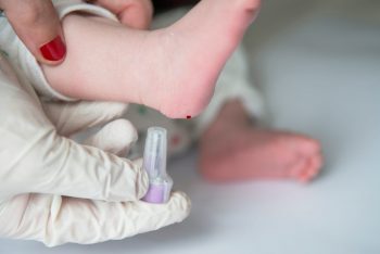 Fenilcetonuria sau deficitul de fenilalanin-hidroxilază