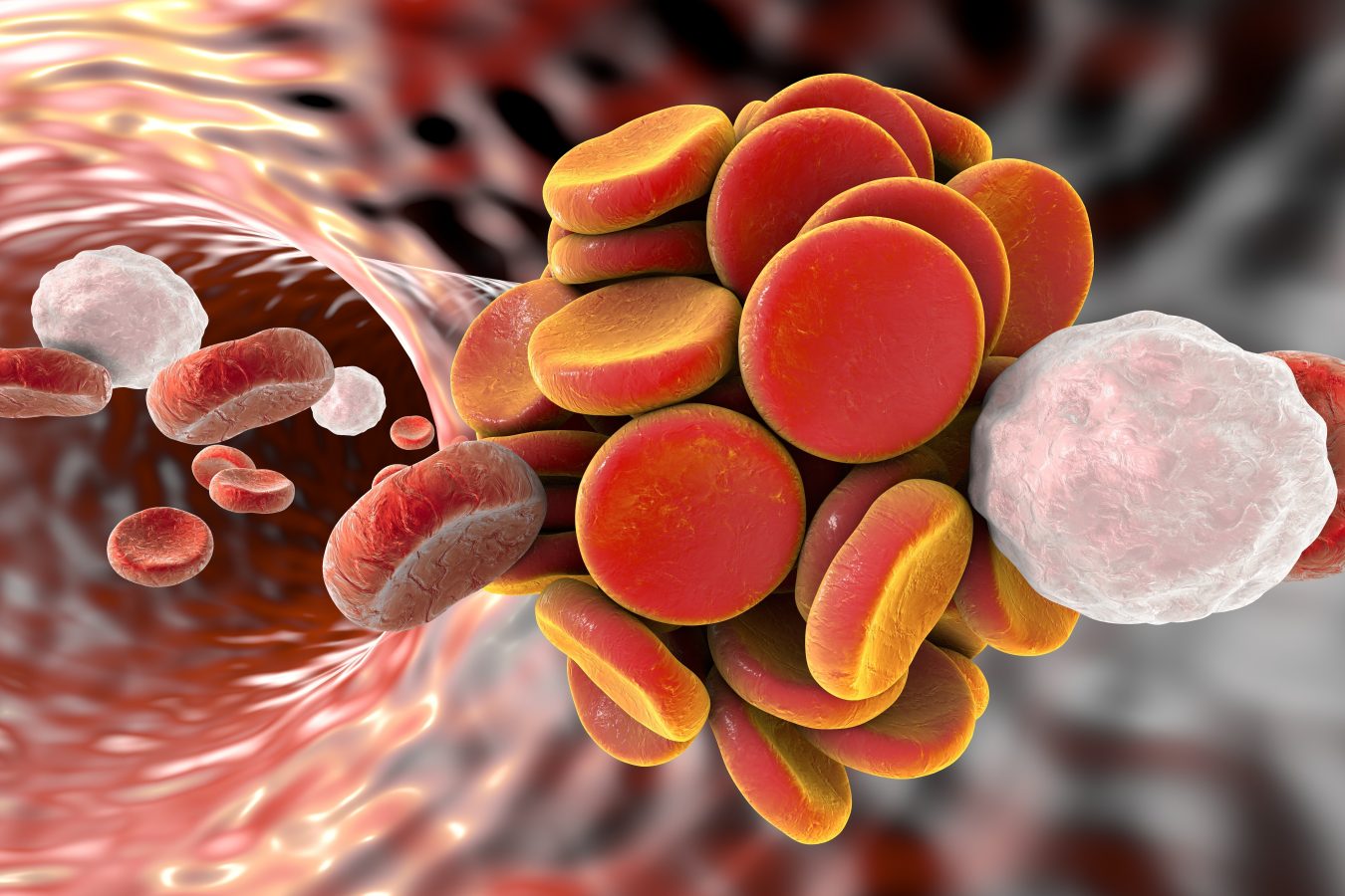 patologia cardiovasculare din punct de vedere fizic)