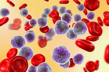 Neoplasmele mieloproliferative BCR-ABL negative