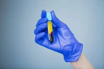 Alianţă a producătorilor de plasmă pentru găsirea unui tratament împotriva coronavirusului