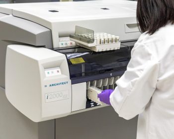 Testul Abbott pentru anticorpi IgG SARS-CoV-2 este disponibil şi în România