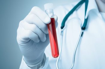 Un test de sânge arată dacă tratamentul pentru cancer de prostată va funcţiona