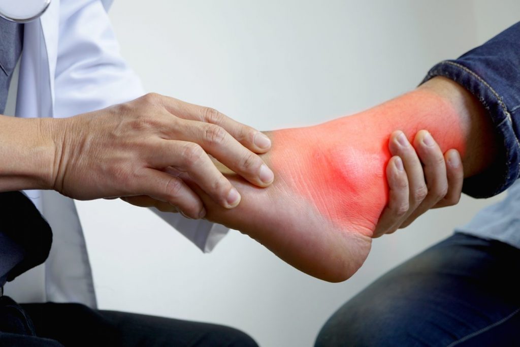 Dureri ale gleznei şi piciorului, Artrita simptome de gleznă și tratament la domiciliu