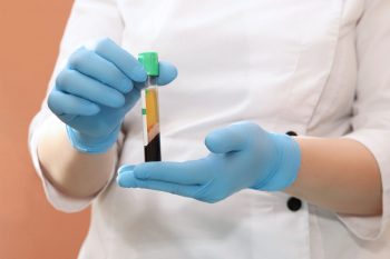 Terapia cu plasmă: beneficii și perspective