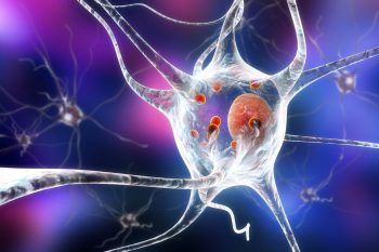 Acumularea de lipide din celulele creierului, risc de Parkinson