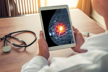 Cancerul de sân: medicamente cu rol de prevenție