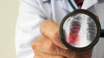 Plămânii s-ar putea regenera dacă oamenii renunţă la fumat