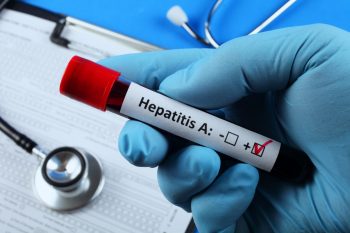Hepatita A, boala mâinilor murdare