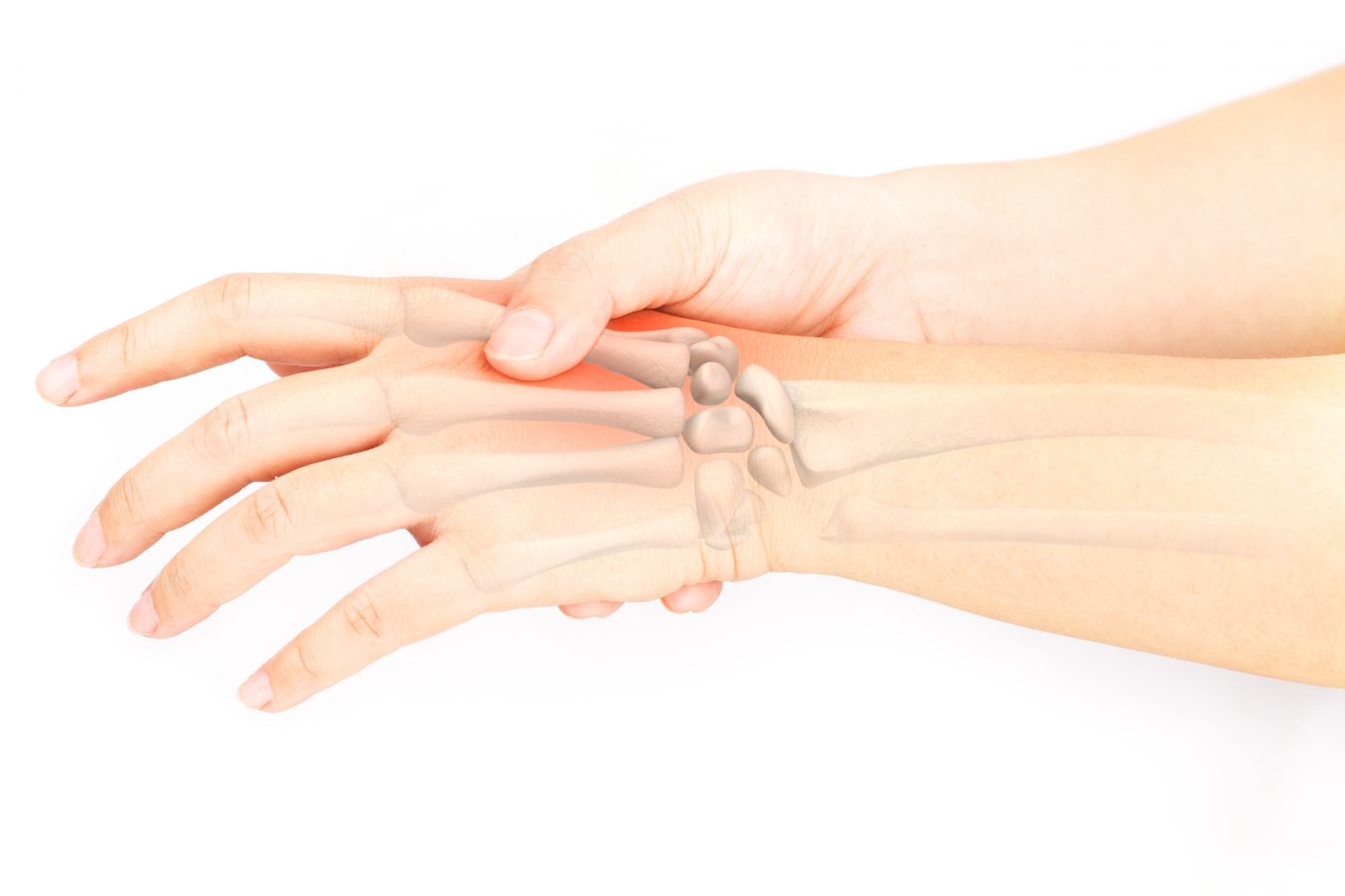 debutul artrozei tratamentul eficient al articulațiilor mâinilor