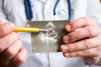 Un nou medicament ar putea preveni calcifierea vaselor de sânge