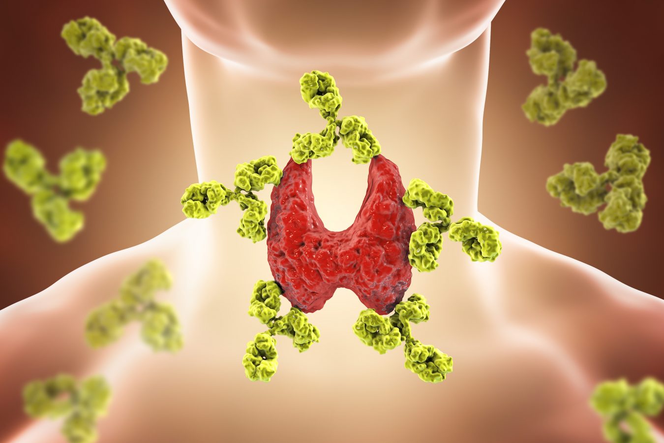 Bolile autoimune: cauze și diagnostic