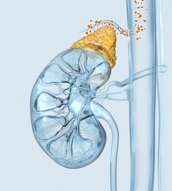 Carcinomul suprarenal, un tip rar de cancer