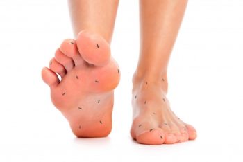 Neuropatiile periferice, clasificare și caracteristici
