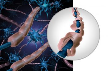 Scleroza multiplă ar putea fi tratată cu ajutorul unei noi tehnologii