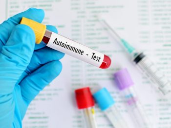 Legătura dintre diabetul zaharat și bolile tiroidiene