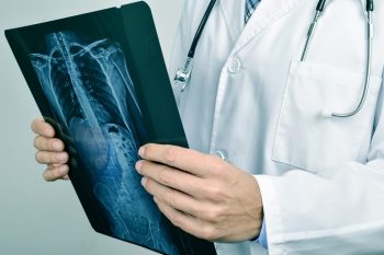 Costocondrita sau inflamaţia oaselor peretelui toracic