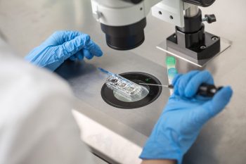Molecula IRE1α joacă un rol important în patogeneza lupusului