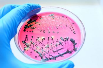 Proteina APOL3 sau „detergentul pentru bacterii”
